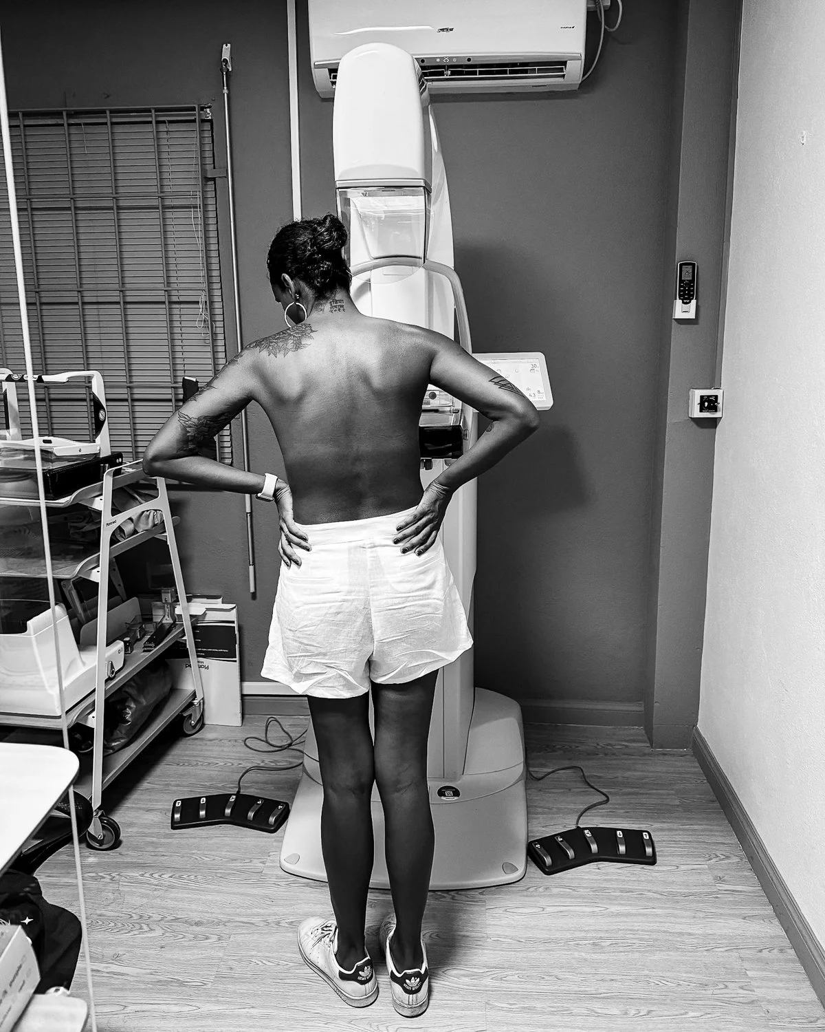 A woman with tattoos standing in front of a breast cancer screening machine in a medical room.